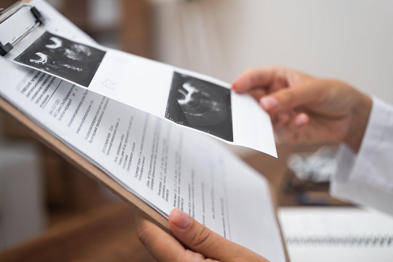 Facture médicale d’échographies avec détails sur les dépassements d’honoraires en France pour une grossesse normale.